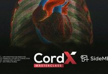 inovatie-si-expertiza-in-cardiologie-la-cordx-masterclass-2026