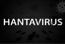 hantavirus:-starea-si-situatia-pacientului,-virusul-luat-de-la-sobolani!