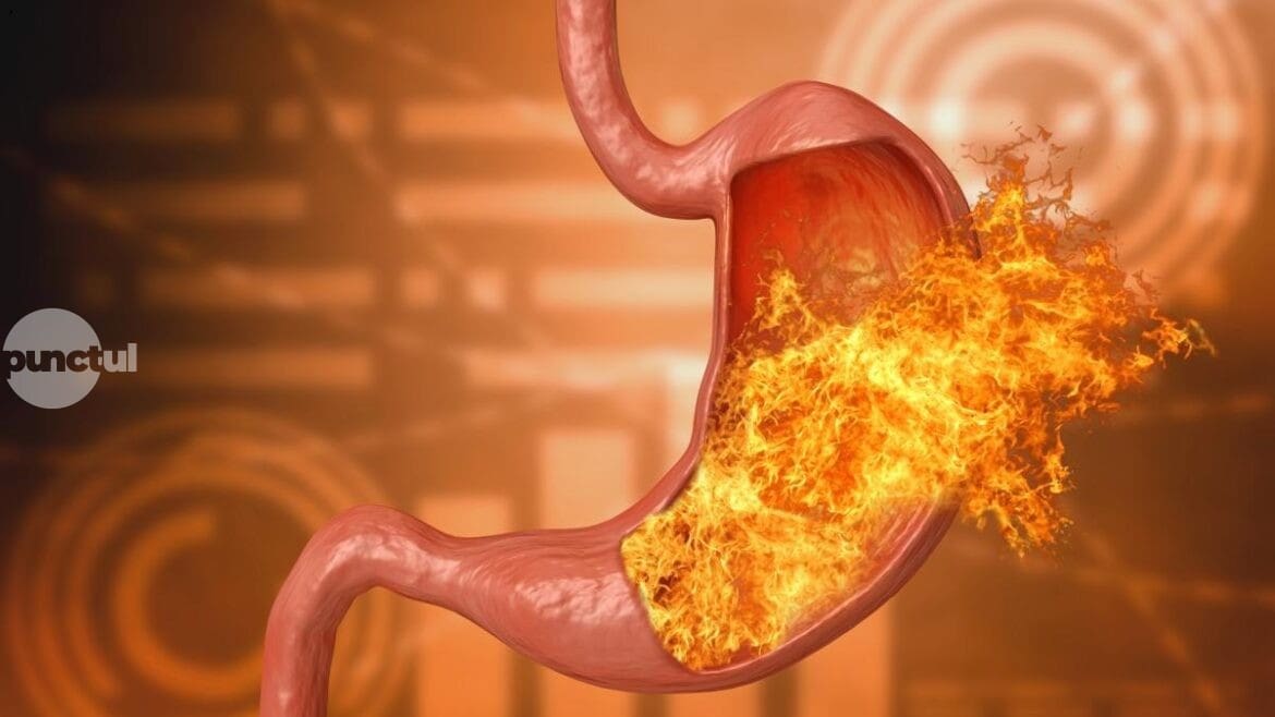 nu-orice-remediu-natural-este-potrivit.-plante-interzise-in-gastrita-si-reflux-gastric