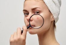 plantele-folosite-pentru-ingrijirea-tenului:-ce-remedii-naturale-sunt-recomandate-pentru-pielea-cu-imperfectiuni