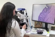 fotoreportaj:-pas-important-in-diagnosticul-oncologic.-laborator-modern-de-anatomie-patologica-la-targu-mures