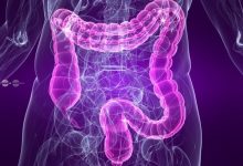 sfecla-rosie,-aliatul-natural-impotriva-colonului-lenes.-cum-poate-fi-consumata-pentru-un-tranzit-intestinal-mai-bun