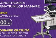 biopsie-mamara-cu-ecografie-gratuita,-la-policlinica-medex