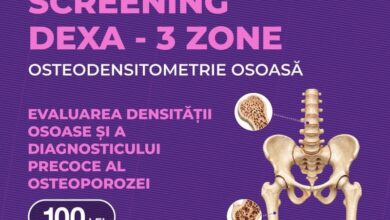 investigatia-dexa-–-trei-zone,-cu-100-de-lei,-la-policlinica-medex