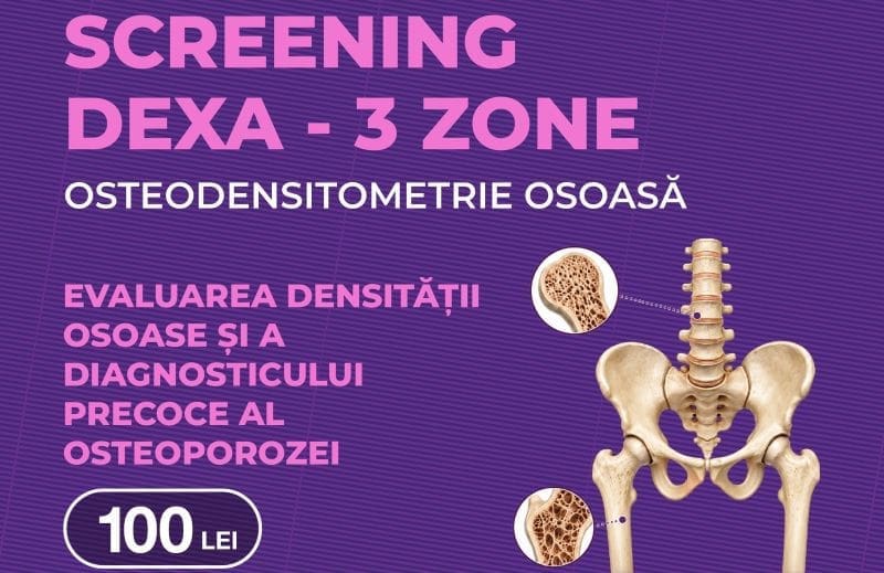 investigatia-dexa-–-trei-zone,-cu-100-de-lei,-la-policlinica-medex